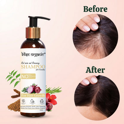 Red onion and Rosemary shampoo - For Hair Growth